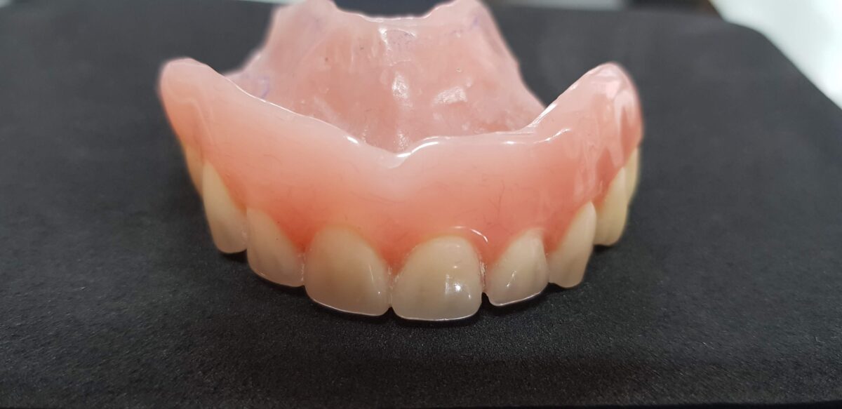 prótesis dental parcial removible en acrilico