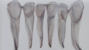 endodoncia en quito