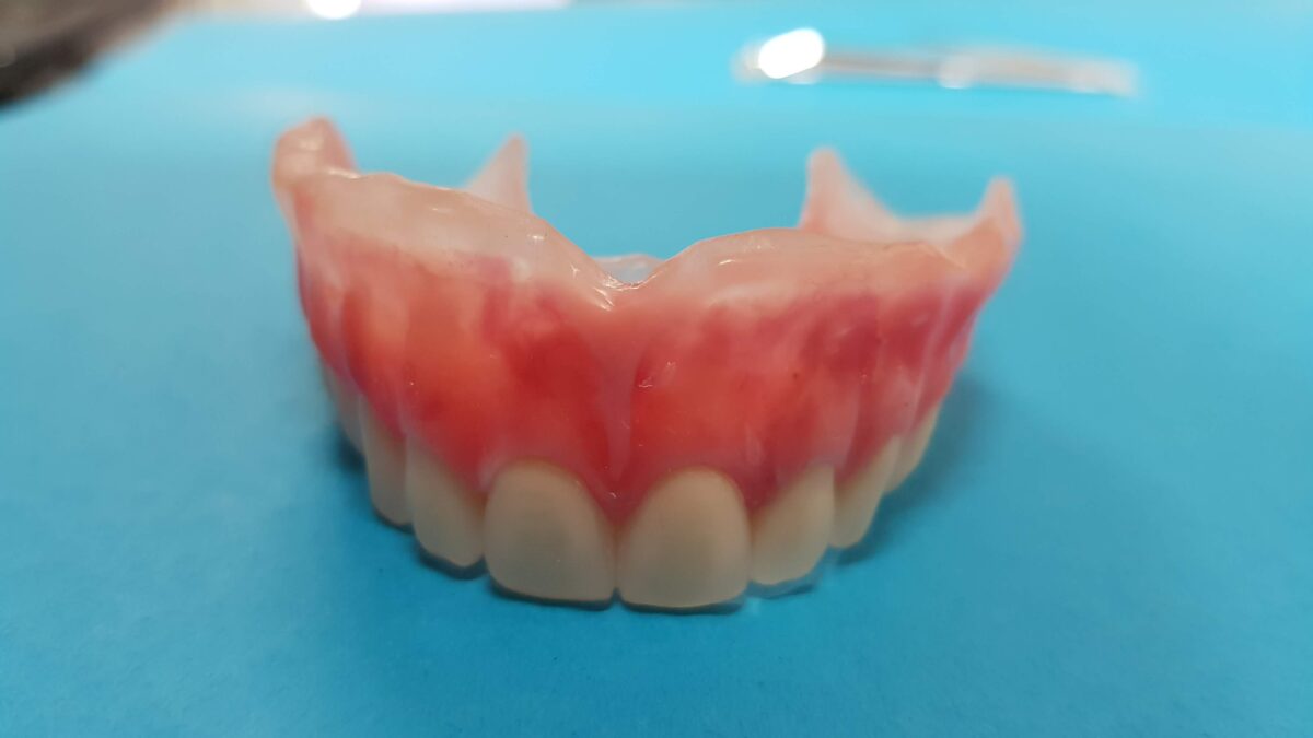 prótesis dental total removible