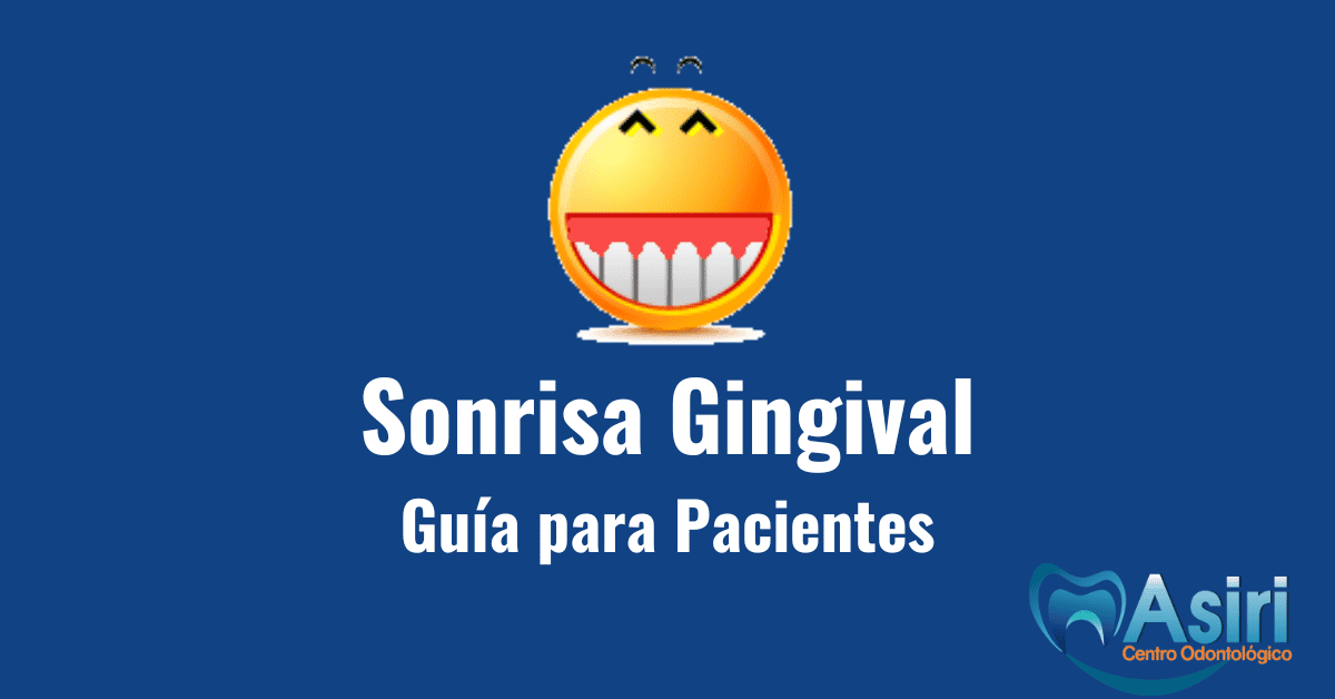 sonrisa gingival