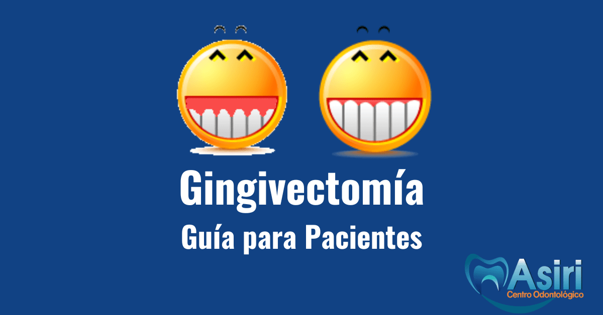 gingivectomía en quito