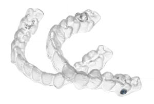 alineadores transparentes en quito