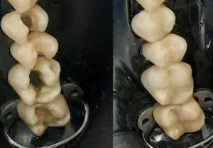 grandes reconstrucciones en resina en quito