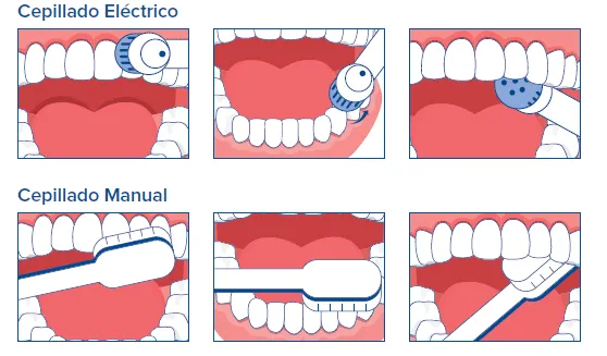 Manual and electric brushing