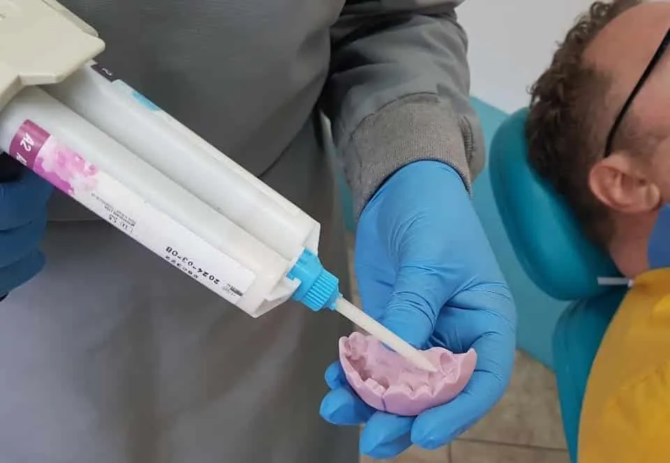 Mockup for dental veneers