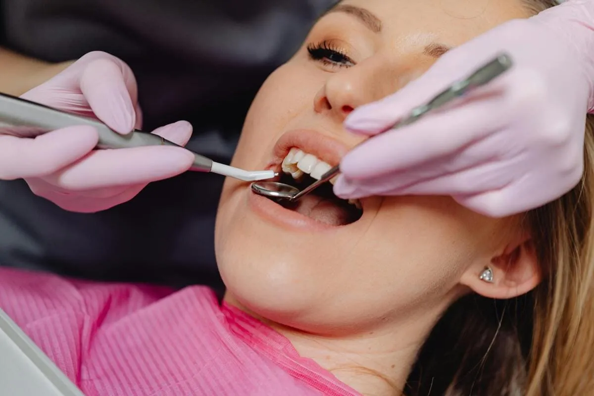 beneficios de la limpieza dental